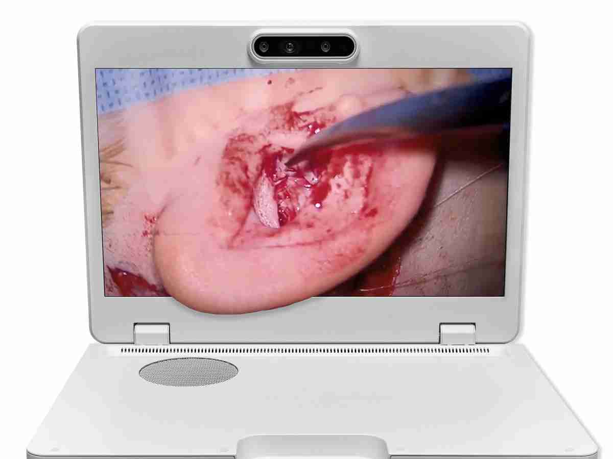 达擎之＂Heads-up 3D显微手术显示系统＂，，，整合4K裸眼3D显示及眼球追踪系统，，，，具备快速追踪人眼移动位置功能，，，，减轻医师长时间维持固定姿势的负担，，，，让医师能有更宽广清晰的3D立体视野及更舒适的姿势来执行手术。。